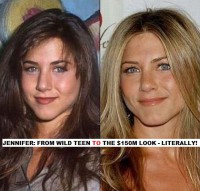 /album/photo-gallery-gloss-goss/celebrities-before-and-after06-jpg/